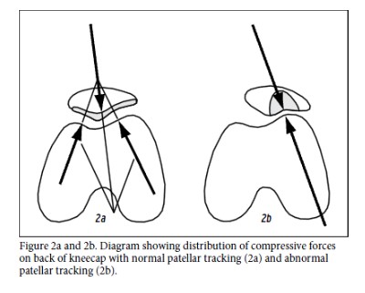 Understanding Anterior Knee Pain and Effective Treatment